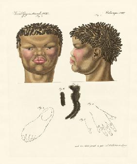 The hottentot or bushman