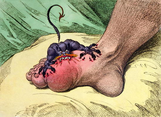 The Gout, published by Hannah Humphrey in 1799 (hand-coloured softdground etching) od James Gillray