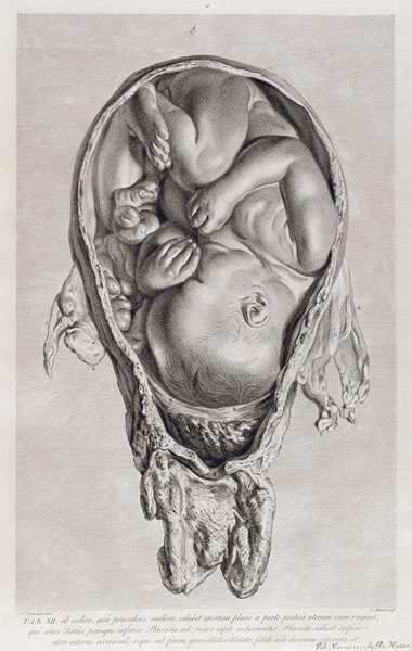 Anatomical drawing of a foetus in the womb od Jan van Rymsdyk