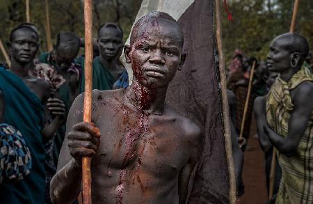 The winner of a Donga Fight in Ethiopia.