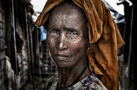 Pride of a Rohingya woman - Bangladesh