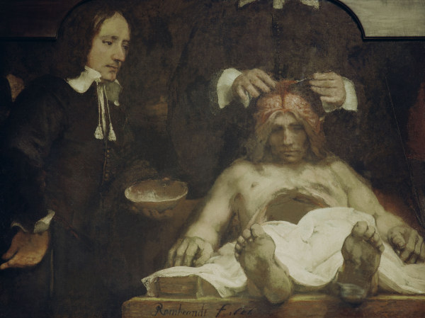 Rembrandt, Anatomie des Dr.J.Deijman od Rembrandt van Rijn